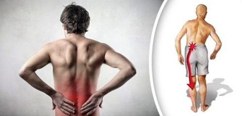 Zuciya ciwo tare da lumbar osteochondrosis haskaka zuwa kafafu